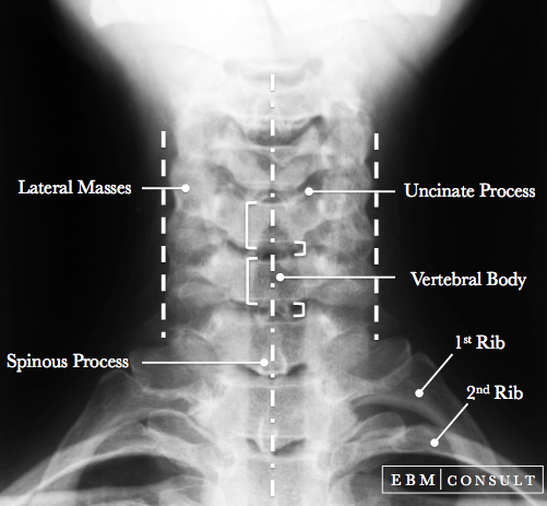 neck anatomy lateral radiography